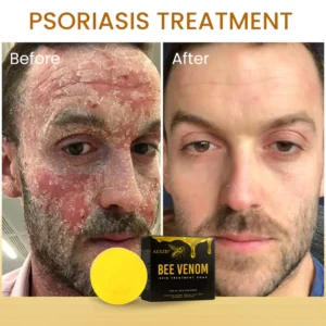 AEXZR® Bee Venom Skin Treatment Soap