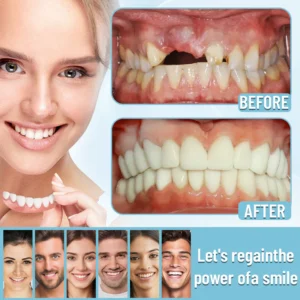 Bikenda®Advanced Full Denture Set 16 Bikenda®Advanced Full Denture Set