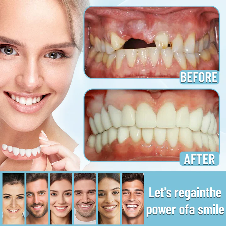 Bikenda®Advanced Full Denture Set 8 Bikenda®Advanced Full Denture Set