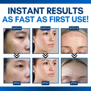 Bikenda® Skin Tag Treatment Pen 9 Bikenda® Skin Tag Treatment Pen