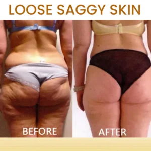 AEXZR® Bee Venom Skin Treatment Soap