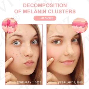 Fivfivgo® Dual Acid Wart & Mole Removal Serum