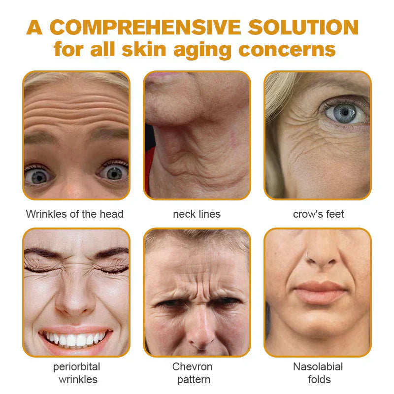 Cvreoz®Botox Bee Venom Wrinkle Removal Cream 3 Cvreoz®Botox Bee Venom Wrinkle Removal Cream