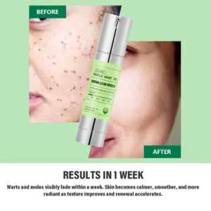 Oveallgo® NEW Korean DermaClear Reedle Shot 100 Wart & Mole Eraser Serum