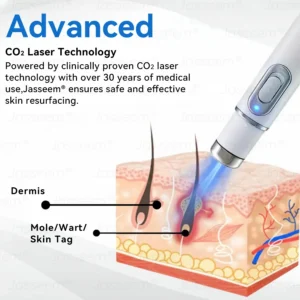 Jasseem® Non-Invasive Mole & Wart Laser Removal Pen