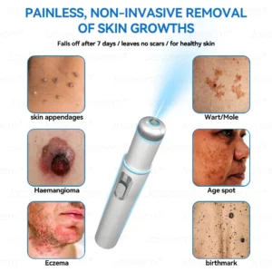Jasseem® Non-Invasive Mole & Wart Laser Removal Pen