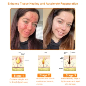 𝗧𝗟𝗢𝗣𝗔™ Powerful All-Body Skin Treatment Cream