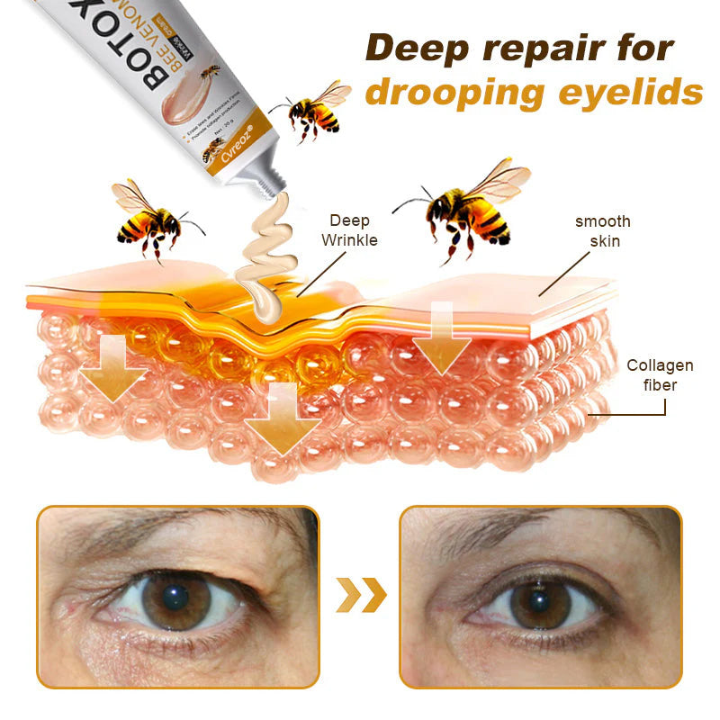 Cvreoz®Botox Bee Venom Wrinkle Removal Cream 7 Cvreoz®Botox Bee Venom Wrinkle Removal Cream