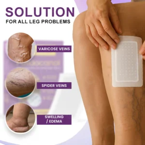 Cvreoz® Polidocanol Nano Patches for Varicose Veins