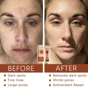 Fivfivgo® Herbal Spots Peel-Off Facial Mask