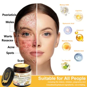 𝗧𝗟𝗢𝗣𝗔™ Powerful All-Body Skin Treatment Cream