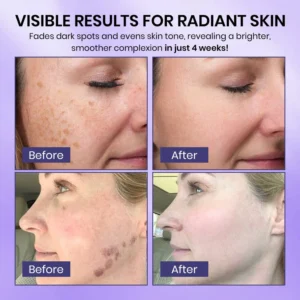 Luhaka® Radiglow Brightening Dark Spot Gel