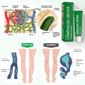 KUBOZN® Lymphatic Detox Herbal Cream