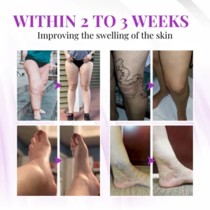 Biancat® VascuSoothe Leg Care Phyto Cream