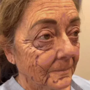 𝗧𝗟𝗢𝗣𝗔™ Powerful All-Body Skin Treatment Cream