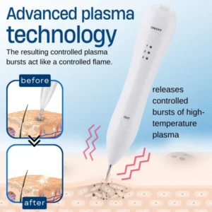 Bikenda® Skin Tag Treatment Pen 10 Bikenda® Skin Tag Treatment Pen