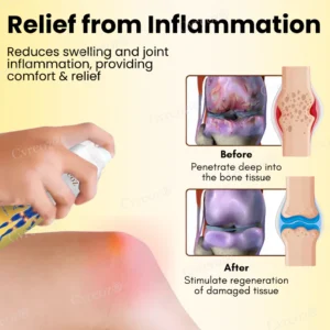 Cvreoz® Magnesium Oil & Bee Venom Joint Healing Spray