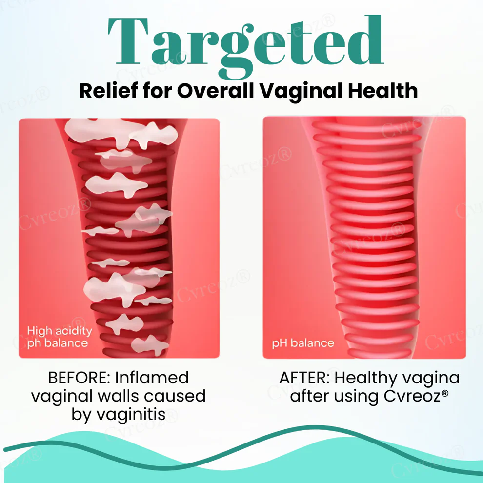 Cvreoz® Female Intimate Care Capsules 4 Cvreoz® Female Intimate Care Capsules