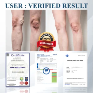 ATTDX® Black Cumin Edema Soothing Herbal Cream 16 ATTDX® Black Cumin Edema Soothing Herbal Cream