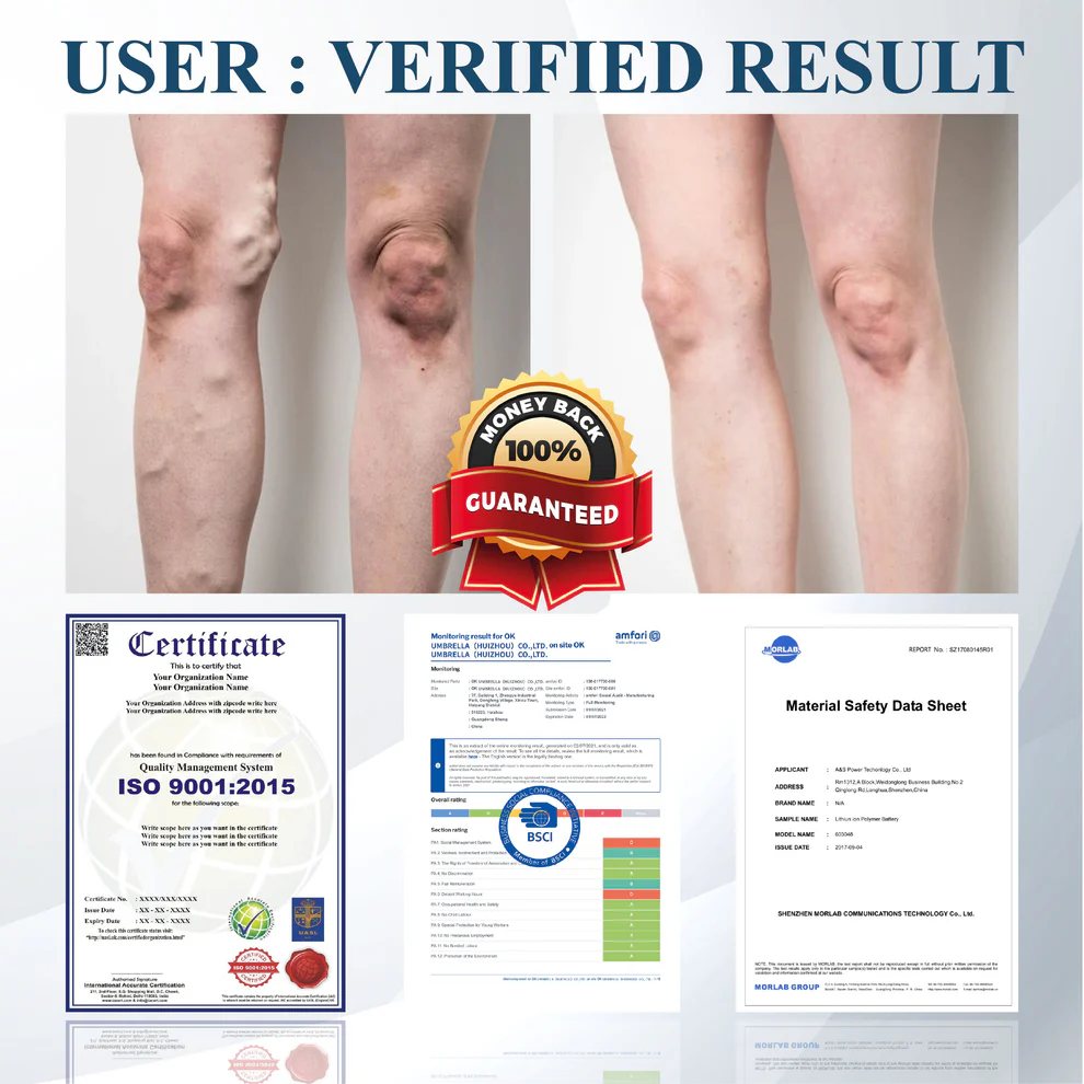 ATTDX® Black Cumin Edema Soothing Herbal Cream 5 ATTDX® Black Cumin Edema Soothing Herbal Cream