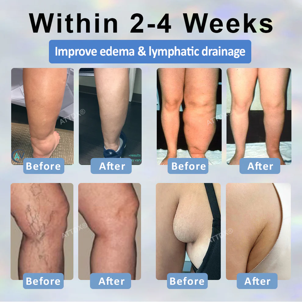 ATTDX® Black Cumin Edema Soothing Herbal Cream 3 ATTDX® Black Cumin Edema Soothing Herbal Cream