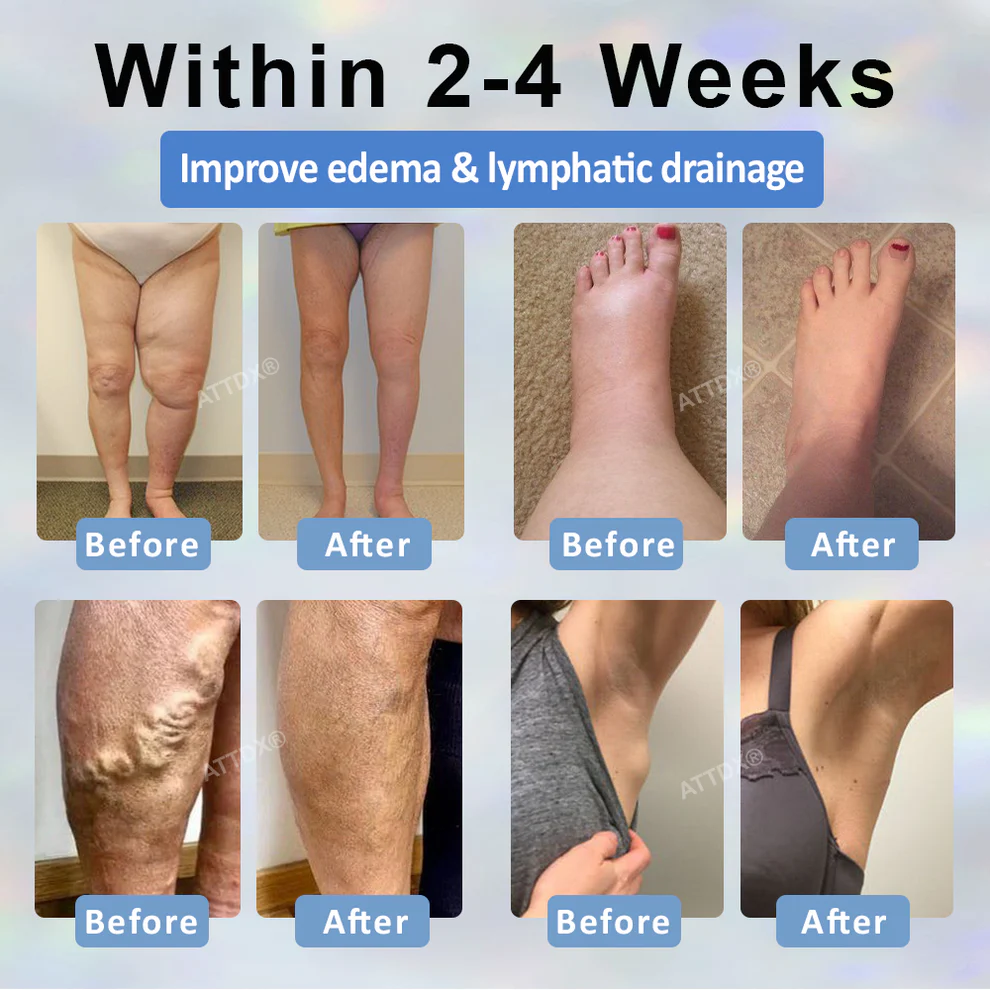 ATTDX® Black Cumin Edema Soothing Herbal Cream 4 ATTDX® Black Cumin Edema Soothing Herbal Cream