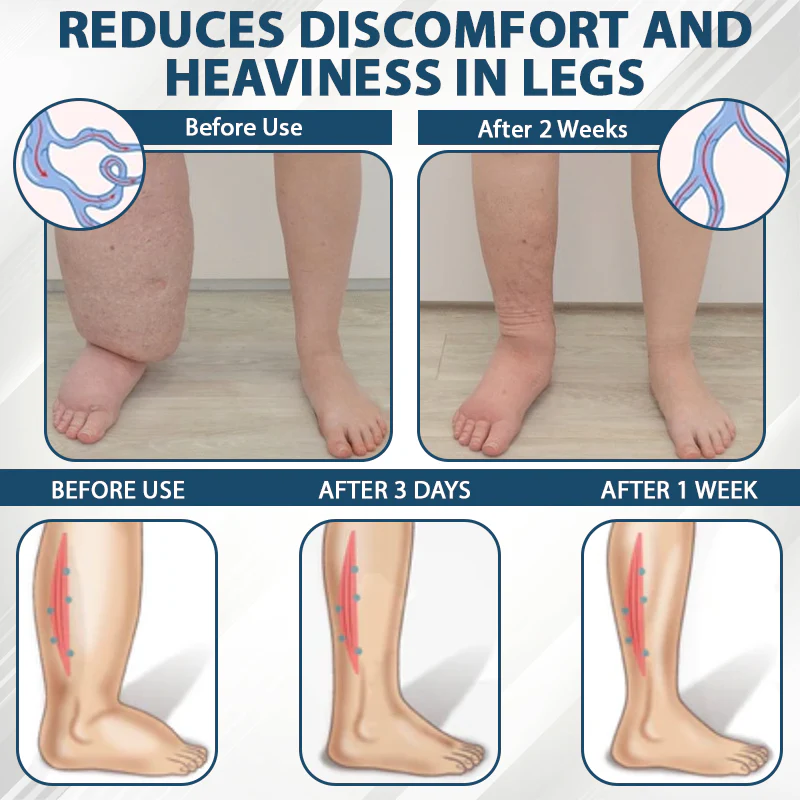 ATTDX® Black Cumin Edema Soothing Herbal Cream 6 ATTDX® Black Cumin Edema Soothing Herbal Cream