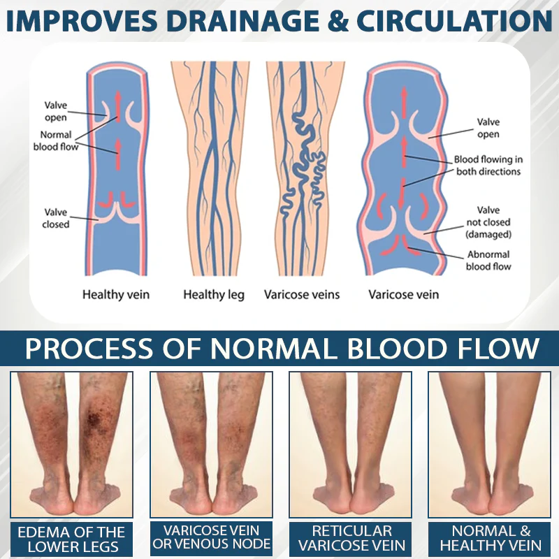 ATTDX® Black Cumin Edema Soothing Herbal Cream 7 ATTDX® Black Cumin Edema Soothing Herbal Cream