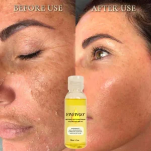 Fivfivgo® Natural Spots Whitening Yellow Peeling Oil