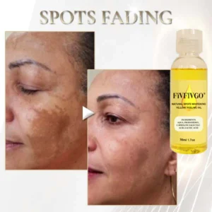 Fivfivgo® Natural Spots Whitening Yellow Peeling Oil
