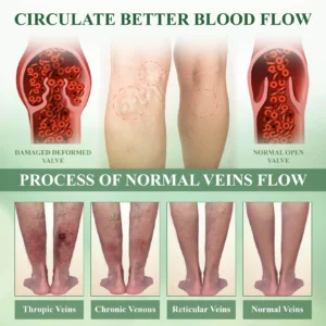 ATTDX® CircuHerb Edema Soothing & Healing Balm 21 ATTDX® CircuHerb Edema Soothing & Healing Balm