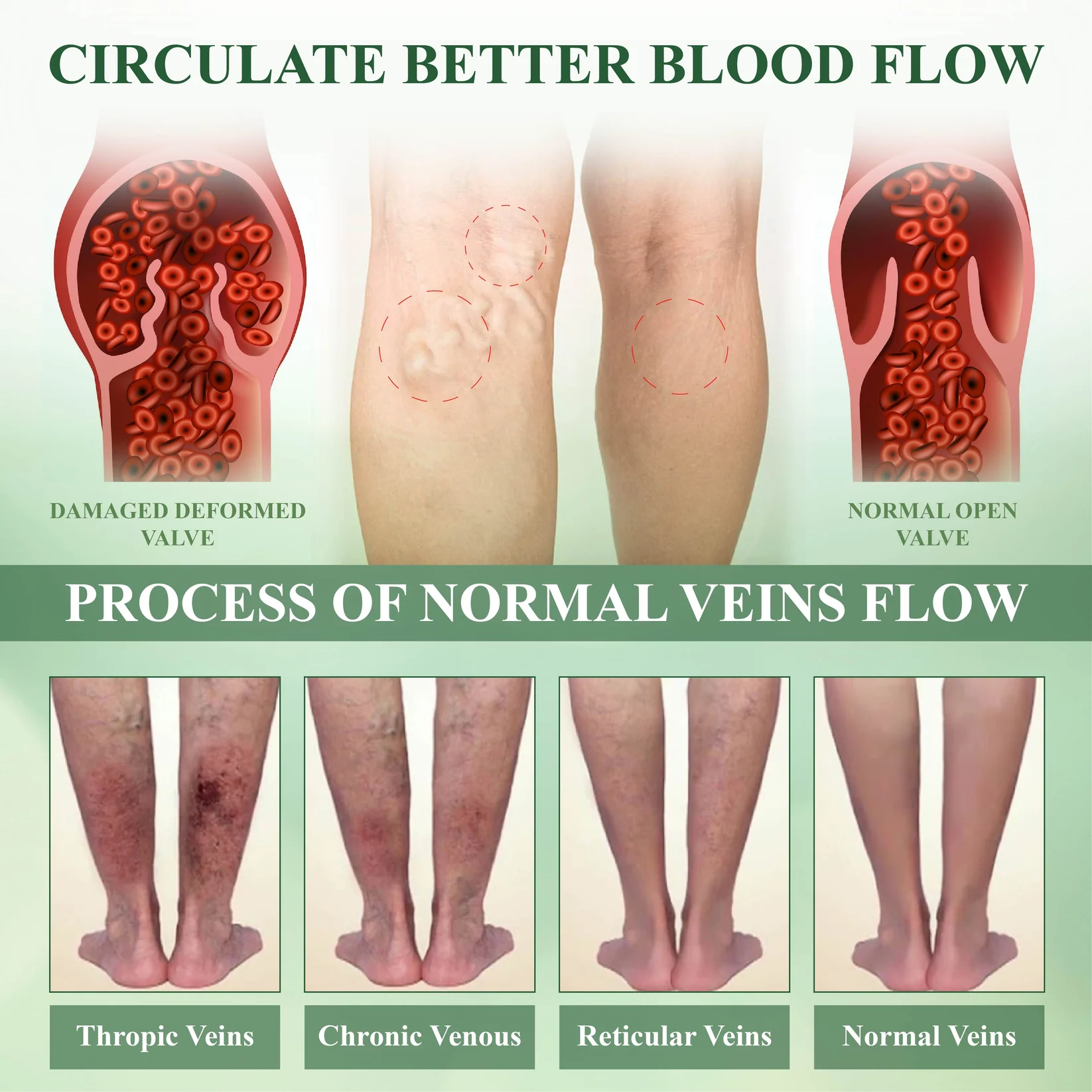 ATTDX® CircuHerb Edema Soothing & Healing Balm 9 ATTDX® CircuHerb Edema Soothing & Healing Balm - Image 9