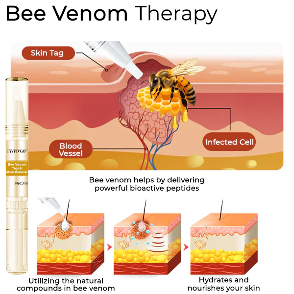 Fivfivgo™ Bee Venom Tags & Moles Remover 3 Fivfivgo™ Bee Venom Tags & Moles Remover