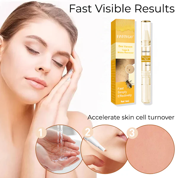 Fivfivgo™ Bee Venom Tags & Moles Remover 4 Fivfivgo™ Bee Venom Tags & Moles Remover