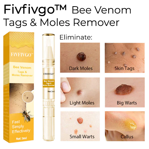 Fivfivgo™ Bee Venom Tags & Moles Remover 2 Fivfivgo™ Bee Venom Tags & Moles Remover