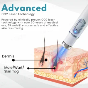 Bikenda® EXTRA Non-Invasive Mole and Wart Removal Laser Pen