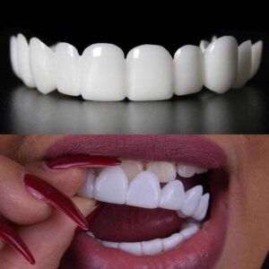Snap-on Teeth Veneers