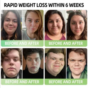 BuildLeaf® Berberine + Moringa GLP-1 Herbal Drops