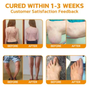 AQA™ Botulinum and Bee Toxin Pain Relief Bone Healing Cream