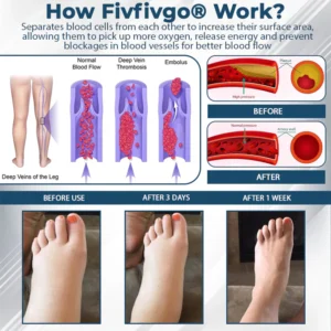 Fivfivgo® VenoHerb Black Cumin Edema Relief Balm