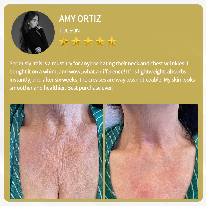 LOVILDS™ Bee Venom Cream — Trusted by Millions for Healthy, Glowing Skin 13 LOVILDS™ Bee Venom Cream — Trusted by Millions for Healthy, Glowing Skin