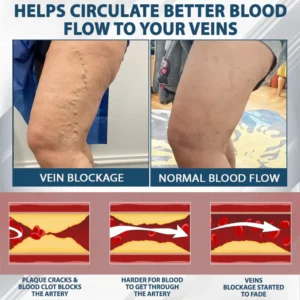 Fivfivgo® VenoHerb Black Cumin Edema Relief Balm