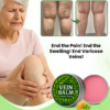 VeinBalm™ Varicose Vein Ointment