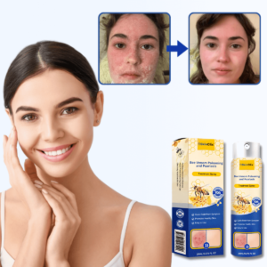 SkinClix™ | Effectively relieves itching and flaking and improves the appearance of psoriatic skin by up to 95% within just a few weeks