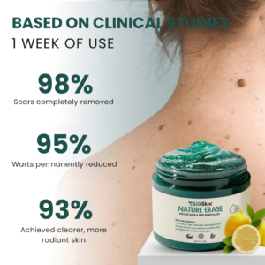SilkSkin™ | Clinically Proven to Remove 97% of Moles, Warts & Blemishes