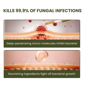 NailCure™ Fungal Nail Drops