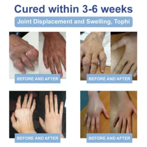 Ourlyard™ Magnesium Pain Healing Bone Cream