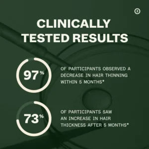 Mizorn Hair Growth Routine | For Women