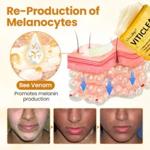 Oveallgo® VitiClear Pro Bee Venom Cream