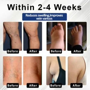 Fivfivgo® VenoHerb Black Cumin Edema Relief Balm